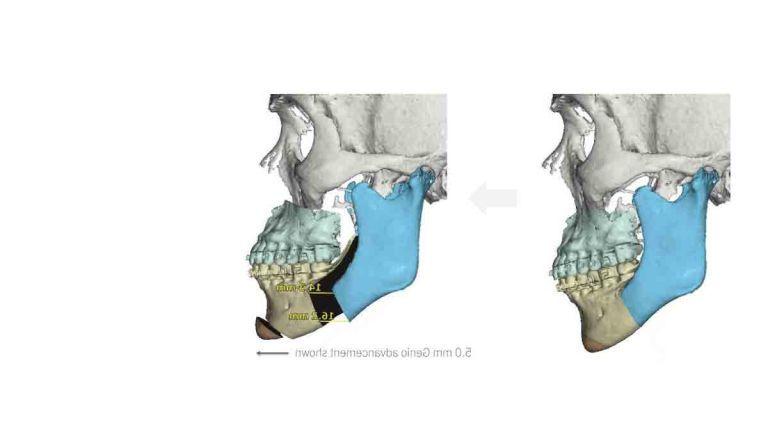 surgery planning